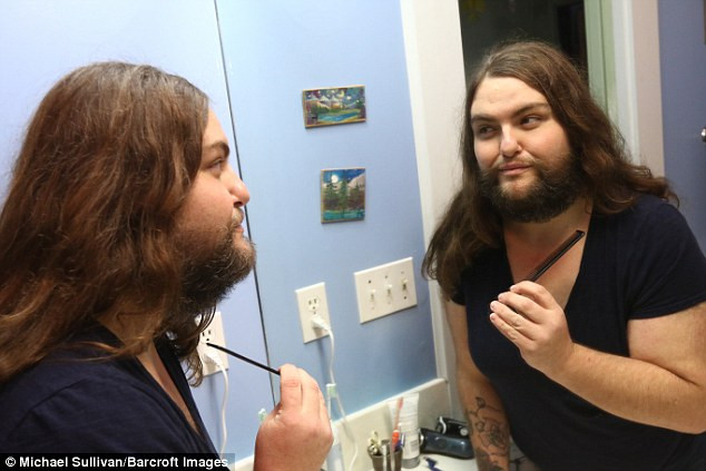 Người phụ nữ tự thấy mình "gợi cảm và nữ tính" với râu quai nón ảnh 3