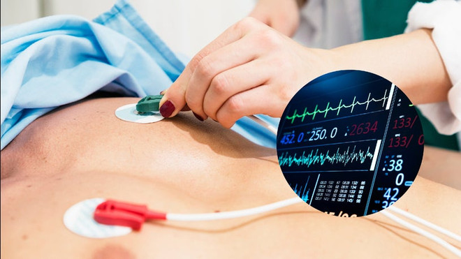 Phương pháp mới giúp chẩn đoán nhanh chứng nhồi máu cơ tim ảnh 1