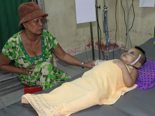 Bị bà ngoại đánh, bé 2 tuổi bị thương nặng phải nhập viện ảnh 1