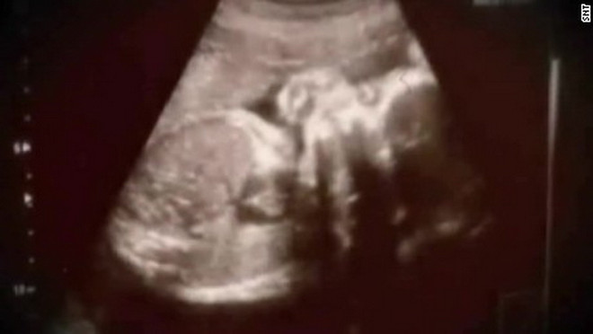 Xôn xao dư luận vụ bé gái mang thai vì bị cha dượng cưỡng bức ảnh 1