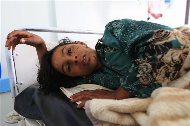 Liên hợp quốc kêu gọi điều tra minh bạch về vụ không kích ở Yemen ảnh 1