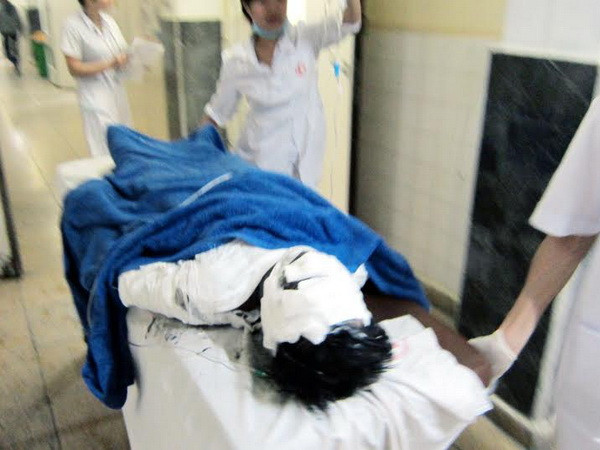 Quảng Ninh: 6 nạn nhân bỏng nặng chưa rõ nguyên nhân ảnh 1