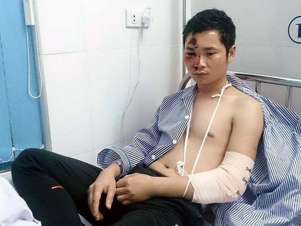 Một giám đốc bị 2 đối tượng dùng gậy truy sát đến bất tỉnh ảnh 1