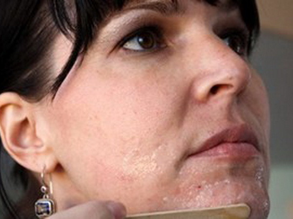 Những mẹo hay và dễ làm giúp bạn thu nhỏ lỗ chân lông ảnh 1