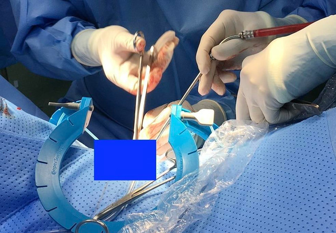 Bà Rịa-Vũng Tàu: Cứu sống 2 người bị đâm vào tim, gan, phổi, cổ ảnh 1