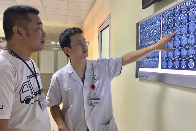 Bị u màng não 10 năm, một người phụ nữ bị mù mắt phải ảnh 1