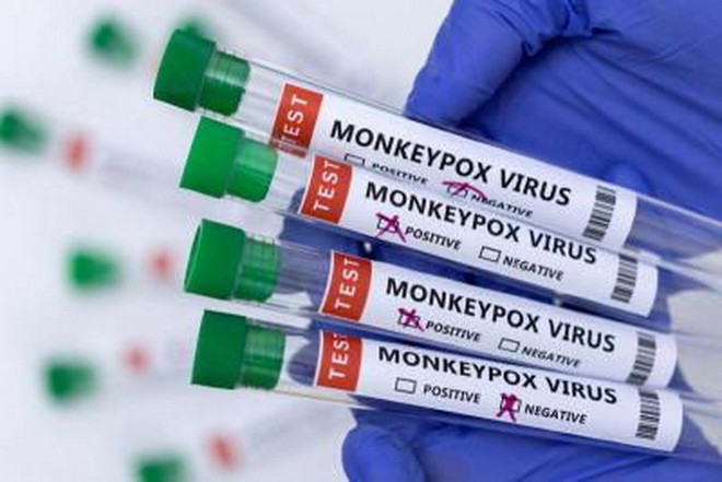 Ảnh minh họa. (Nguồn: thestar.com.my) Lào sẵn sàng ứng phó nguy cơ bùng phát virus đậu mùa khỉ ảnh 1