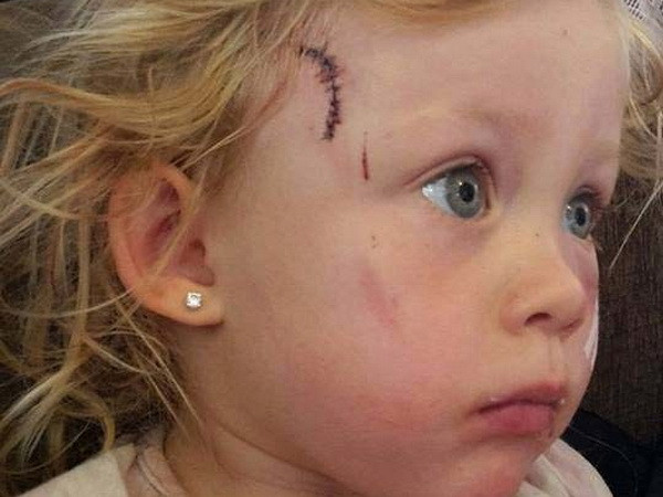 Bé gái 3 tuổi suýt chết vì đồ nội thất nguy hiểm của IKEA ảnh 1