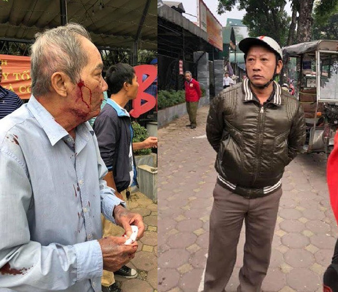Hình ảnh trên mạng xã hội về người đàn ông lái xe ôm hành hung cụ ông 80 tuổi. Hà Nội: Điều tra vụ cụ ông 80 tuổi bị hành hung phải nhập viện ảnh 1