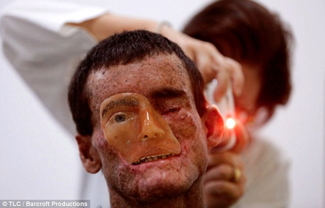 Brazil: Chứng bệnh lạ khiến người dân bị thiêu đốt khi ra nắng ảnh 2