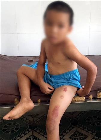 Hội đồng Đội TW kiến nghị xử lý nghiêm các hành vi bạo hành trẻ em ảnh 2