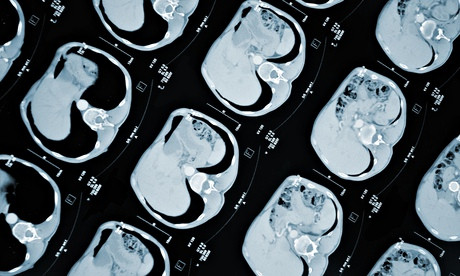 Tạo ra "dạ dày mini" đầu tiên bằng phương pháp tế bào gốc ảnh 1