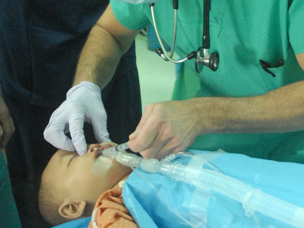 Ba trẻ tử vong sau phẫu thuật từ thiện sứt môi, hở hàm ếch ảnh 1