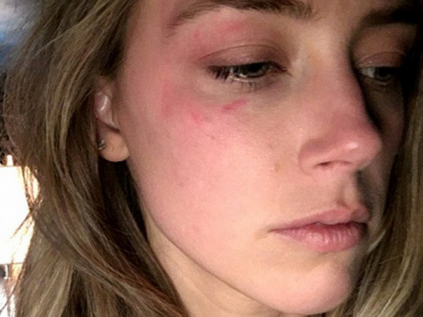 Tiết lộ lý do kinh khủng khiến Johnny Depp bị vợ trẻ bỏ ảnh 1