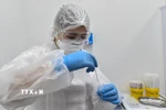 Nhân viên y tế nghiên cứu mẫu bệnh phẩm tại Moscow (Nga). (Ảnh: AFP/TTXVN)