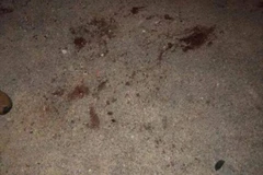 Hưng Yên: Cháu bé 7 tuổi bị cả đàn chó tấn công đã không qua khỏi