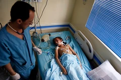  Điều trị cho một học sinh bị thương trong vụ nổ được cho là không kích ở thủ đô Sanaa, Yemen ngày 7/4/2019. (Ảnh: THX/TTXVN)