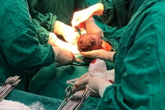 Bé Đàm Thị Phương Mai cất tiếng khóc chào đời lúc 0 giờ 3 phút ngày 1/1/2019 bằng phương pháp sinh mổ. (Nguồn: Bệnh viện Phụ sản Trung ương)