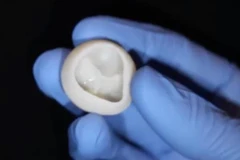 Một van tim chức năng không có collagen được tạo ra bằng máy in 3D. (Ảnh: AFP)