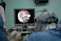 Phẫu thuật nội soi tim bẩm sinh cho bệnh nhi. (Ảnh: Mạnh Linh/TTXVN)