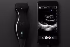 Thiết bị Butterfly iQ.