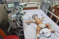 Quảng Bình: Cứu sống bệnh nhi 8 tháng bị ngạt khi rơi vào thùng nước