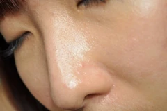 Hai công thức lợi hại giúp phái đẹp "đánh bay" mụn đầu đen