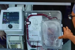 Kỳ tích y học Anh: Cấy ghép thành công tim không còn đập