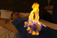 Kỳ bí phương pháp chữa bệnh bằng lửa tại Trung Quốc