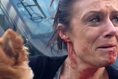 Một phụ nữ đổ máu để bảo vệ tính mạng chú chó cưng