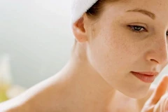 Tàn nhang hình thành do sự gia tăng sắc tố melanin của da.