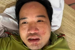 Trạm trưởng Kiểm lâm Trung Lý (huyện Mường Lát) Lê Duy Cường đang được cấp cứu tại Bệnh viện Đa khoa huyện Mường Lát. (Ảnh: TTXVN phát)
