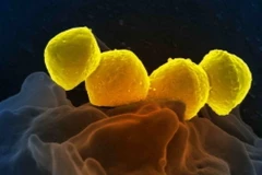 Vi khuẩn Liên cầu khuẩn nhóm A. (Ảnh: Getty)