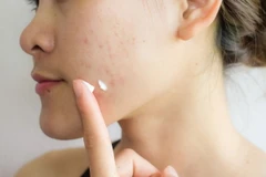 (Nguồn: Getty images)