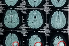 (Nguồn: Facebook BVXA - Bệnh Viện Đa Khoa Xuyên Á)