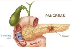 Ảnh minh họa. (Nguồn: funscrape.com) 