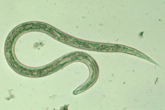 Khoa học giải mã thành công bộ gen của giun móc