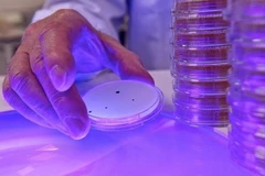 Điều trị bệnh lao kháng thuốc bằng tế bào gốc tủy xương