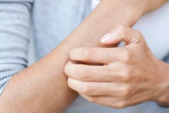 Ảnh minh họa. (Nguồn: Prevention)