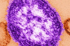 Virus bệnh sởi. (Nguồn: businessinsider.com.au)