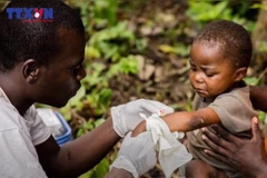 [Video] Cơ chế lây nhiễm khiến đậu mùa khỉ là bệnh khẩn cấp toàn cầu