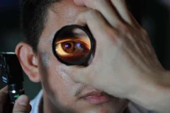 COVID-19 làm tăng nguy cơ xuất hiện cục máu đông ở mắt. (Nguồn: weather.com)