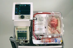 Australia cấy ghép thành công tim đã ngừng đập cho bệnh nhân