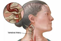 Ảnh minh họa. (Nguồn: riversideonline.com)