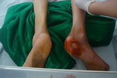 (Ảnh: Thanh Sang/Vietnam+)