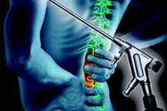 Ảnh minh họa. (Nguồn: Internet)