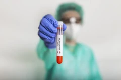 (Nguồn: Africa CDC)