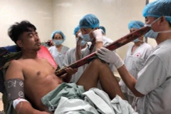Thanh sắt đâm vào ngực của bệnh nhân. (Ảnh: PV/Vietnam+)