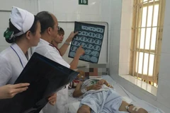 Phó giáo sư Đỗ Duy Cường thăm khám cho bệnh nhân Whitmore. (Ảnh: PV/Vietnam+)