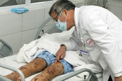 Bác sỹ Bệnh viện Bệnh Nhiệt đới Trung ương kiểm tra sức khỏe cho bệnh nhân viêm não mô cầu hồi năm 2012. Ả tư liệu. (Ảnh: Dương Ngọc/TTXVN)